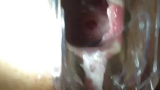 Төлөвшсөн шаргал болон хар үстэй галзуугийн дээд зэргийн